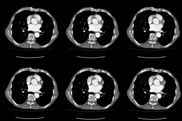 Scan Komputertomográfia Egész Has Kontraszttal Komputertomográfia Egész Has Axiális Rész — Stock Fotó