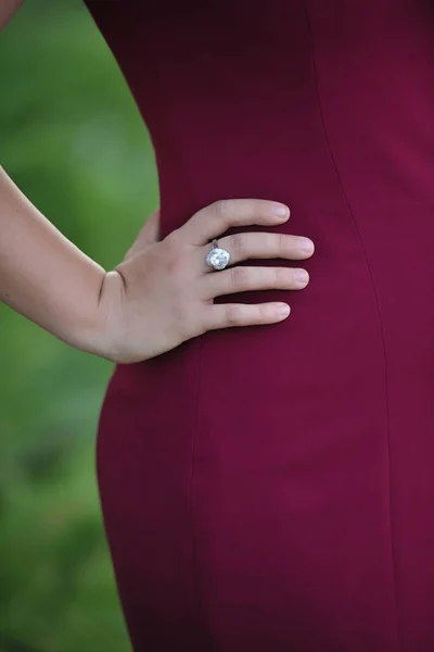 Hermosa Chica Con Mano Cadera Parque Anillo Mano Derecha — Foto de Stock