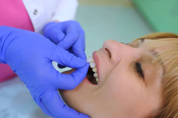 Tandläkare Sätter Tandfasader Patient Och Korrigering Tänder — Stockfoto