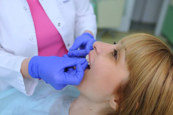 Tandläkare Sätter Tandfasader Patient Och Korrigering Tänder Estetisk Tandvård — Stockfoto