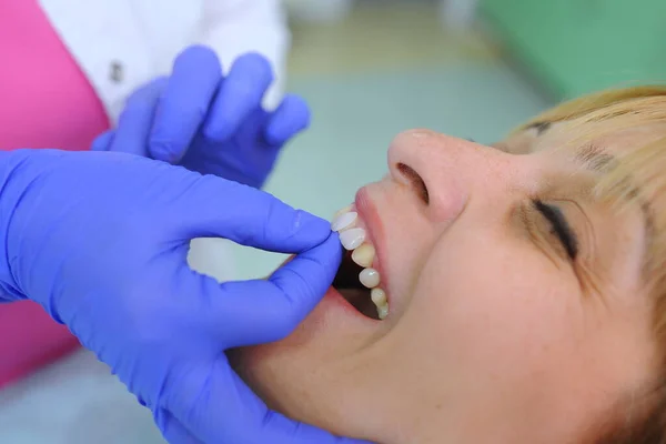 Οδοντίατρος Βάζει Οδοντοστοιχίες Ασθενή Και Διόρθωση Των Δοντιών Αισθητική Οδοντιατρική — Φωτογραφία Αρχείου