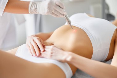 Profesyonel güzellik kliniğinde randevusu sırasında karın bölgesinden lazer tedavisi gören kimliği belirsiz kadın hasta.