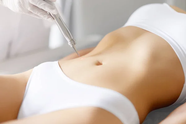 Crop Anonymous Female Patient Receiving Laser Skin Care Procedure Stomach — Stock Photo, Image