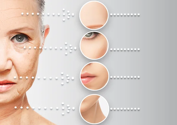 Schönheitskonzept Hautalterung. Anti-Aging-Verfahren, Verjüngung, Lifting, Straffung der Gesichtshaut — Stockfoto