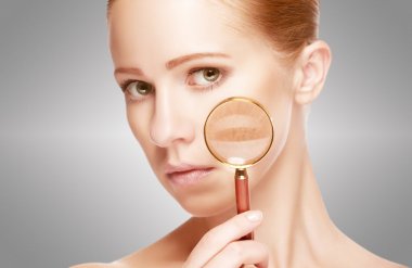 Concept skincare. Skin of woman with magnifier before and after the procedure