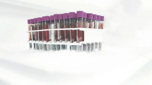 Donmuş kan tüpleri laboratuvar buzdolabında saklanıyor. DNA ve RNA biyo-kayıt örnekleri dondurucuyu kapatın..