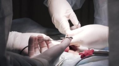 Testis kanseri olan bir hastanın cinsel organlarını kapatın. Başla. Cerrahlar, bir hastanedeki ameliyathanede erkek testislerinden tümör çıkarıyorlar..