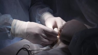 Close up of surgeons making procedure of the foreskin circumcision. Action. Human anatomy concept, doctors sewing up the wound on male penis.