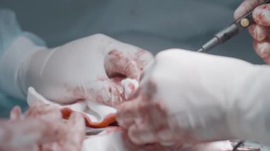 Operation on male organ. Action. Close-up of bloody operation on male sexual organ. Penis Enlargement Surgery