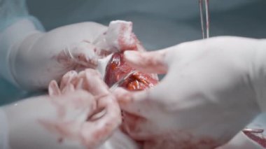 Operation on male organ. Action. Close-up of bloody operation on male sexual organ. Penis Enlargement Surgery