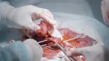Bloody operation on organ. Action. Close-up of lot of blood during surgery on male genital organ. Fracture of penis or its increase with surgery