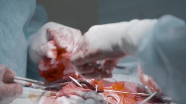 Kan ve etten oluşan yakın plan bir operasyon. Başla. Cerrahlar kanamayı durdurur ve kanlı et ya da organ keser. İç organları kanlı, karmaşık bir operasyon.