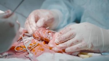 Operation on male organ. Action. Close-up of bloody penis operation. Surgeons operate on male genital organ for treatment or enlargement