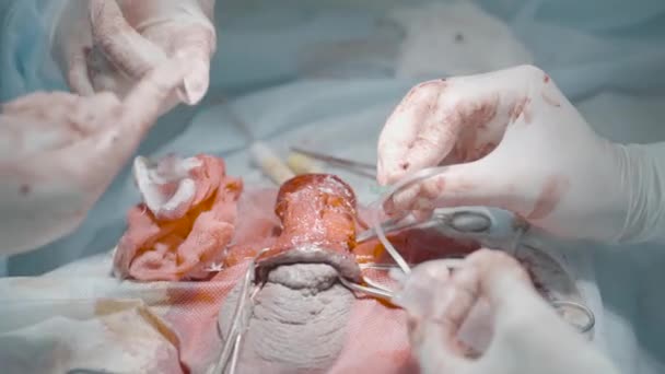 Operation on male organ. Action. Close-up of bloody penis operation. Surgeons operate on male genital organ for treatment or enlargement — Wideo stockowe