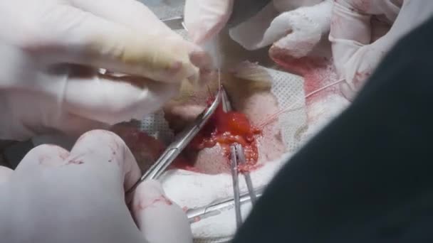 Legatura chirurgica di sutura. Azione. I chirurghi professionisti legano i punti con le mani sulla ferita aperta. Operazioni di sutura con incisione aperta e organi interni — Video Stock