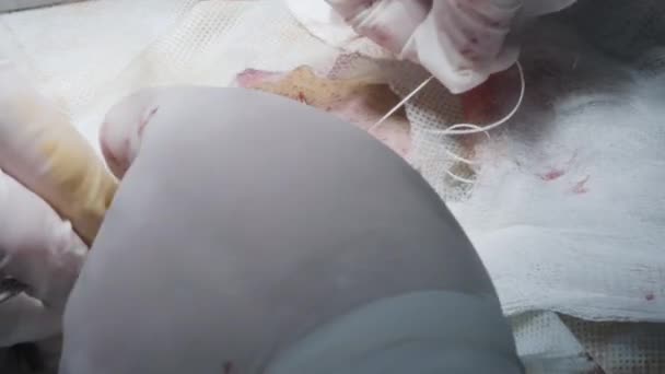 Surgical suture tying. Action. Professional surgeons tie stitches with their hands on open wound. Suturing operations with open incision and internal organs — Stock Video