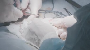 Doktorlar apandisti almak için ameliyat yaparlar. Başla. Cerrahlar anestezi altında kişiyi ameliyat ederler. Tümör alınması ve organ ameliyatı