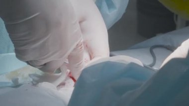 Açık yarayı dikiyorum. Başla. Yakın plan cerrahlar yaralara ya da iç organlara dikiş atarlar. Tümörün alınması ve organların dikilmesi