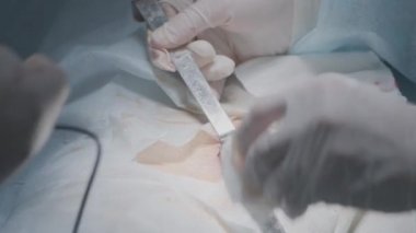 Cerrahi lazer neşteri. Başla. Lazer neşterli düzgün kesikler. Cerrah, lazer neşterle dokuyu kesip dağlıyor. Ameliyatta kesin kesikler için elle kullanılan lazer neşter.