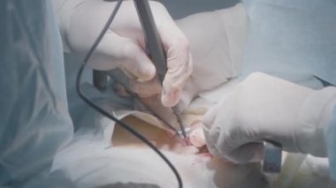 Cerrahi lazer neşteri. Başla. Lazer neşterli düzgün kesikler. Cerrah, lazer neşterle dokuyu kesip dağlıyor. Ameliyatta kesin kesikler için elle kullanılan lazer neşter.