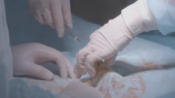Mãos de cirurgiões a cortar tecidos. Acção. Mãos profissionais de cirurgiões que fazem incisões em tecidos de couro. Tesouras e bisturis em cirurgiões durante a cirurgia — Vídeo de Stock