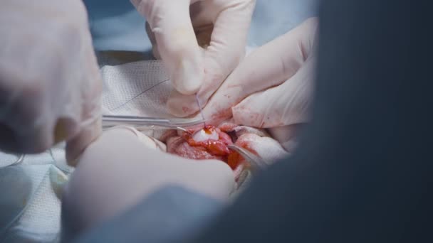 หมอผ่าตัดทํางานกับแผลเปิดและอวัยวะ การกระทํา ศัลยแพทย์ตัดและเย็บแผลเปิดในอวัยวะ การผ่าตัดเปิดอวัยวะภายใน ผสมกับอวัยวะขนาดเล็กที่เปิดอยู่ — วีดีโอสต็อก