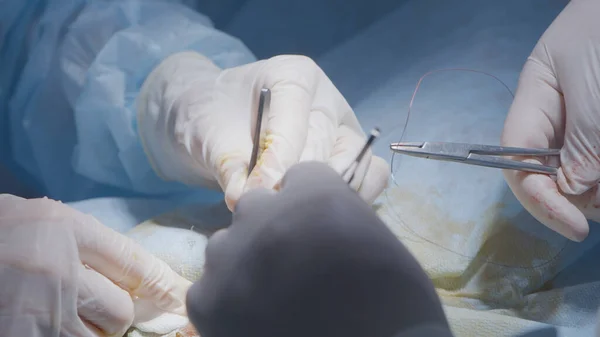 A sebészek varratokat alkalmaznak. Felvétel. Sebészeti varratok alkalmazása altatásban szenvedő betegen. A sebészek szakmailag és körültekintően alkalmazzák a varratokat súlyos műtét után — Stock Fotó