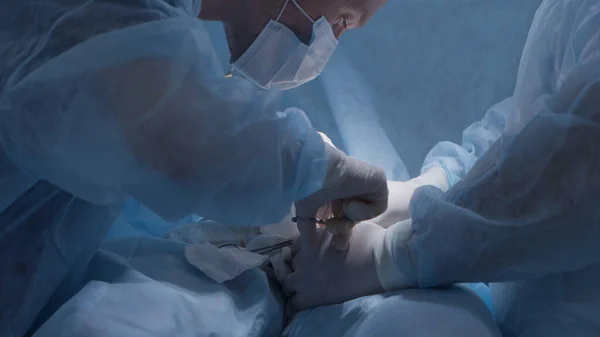 A sebészek altatásban operálják a beteget. Felvétel. A két legjobb sebész komplikációkkal operálja a beteget. A sebész és asszisztens komplex műtétet végez érzéstelenítésben. — Stock Fotó