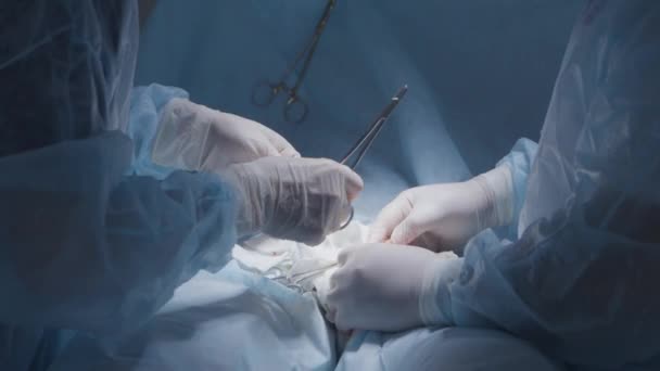 Sutura durante la cirugía. Acción. Las manos de cirujanos profesionales rápidamente hacen frente a la sutura. Cirujano ata nudos para puntadas en herida abierta — Vídeos de Stock