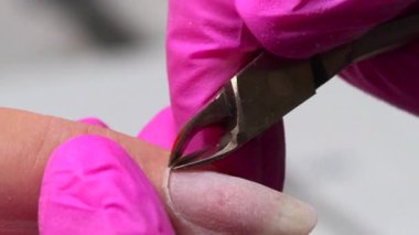 Pembe Eldiven Teknisyeni Dikkat Şeytan Tırnağı Çıkarma 'dan 