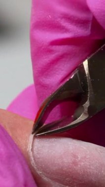 Pembe Eldiven Teknisyeni Dikkat Şeytan Tırnağı Çıkarma 'dan 