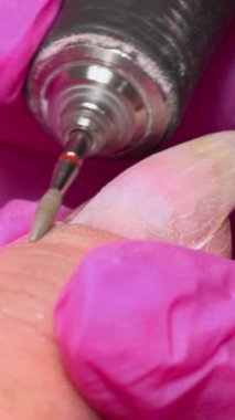 Pembe Eldiven Teknisyeni, Dikkatli Şekillendirme 'den 