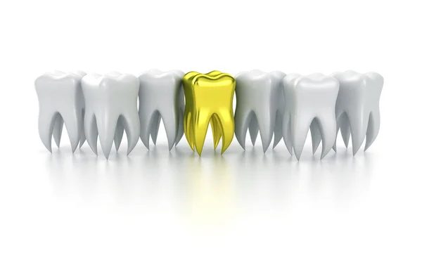The human teeth — Stock Photo, Image