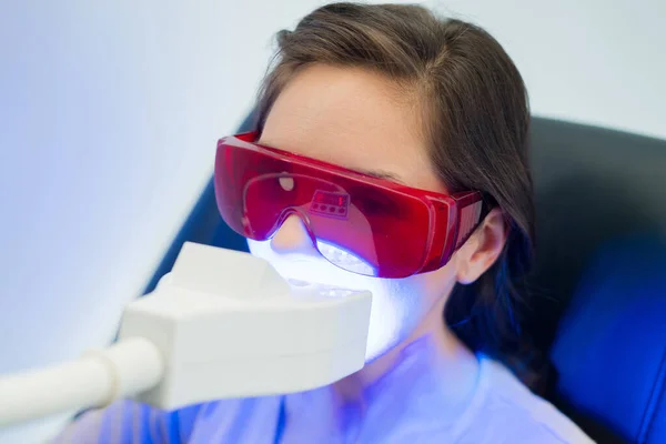 Sbiancamento Dei Denti Con Laser — Foto Stock