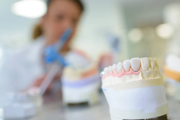 Protesi Dentaria Dentista Sullo Sfondo — Foto Stock