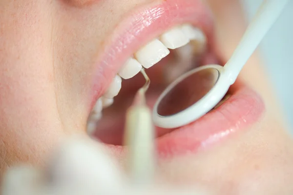 Крупним планом жінка у стоматолога — стокове фото