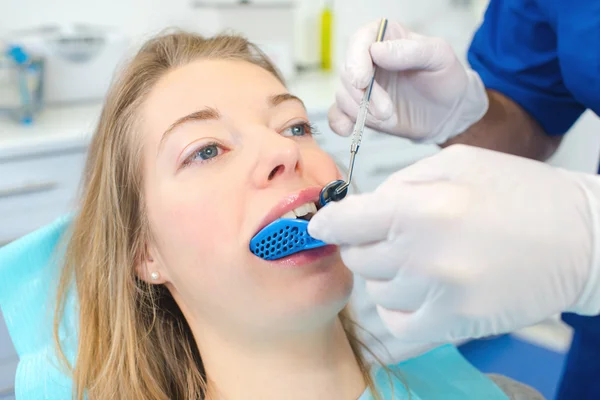 Mujer con los dientes moldeados — Foto de Stock