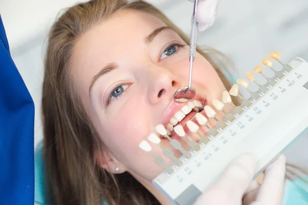 Trovare la giusta tonalità per il dente di ricambio — Foto Stock