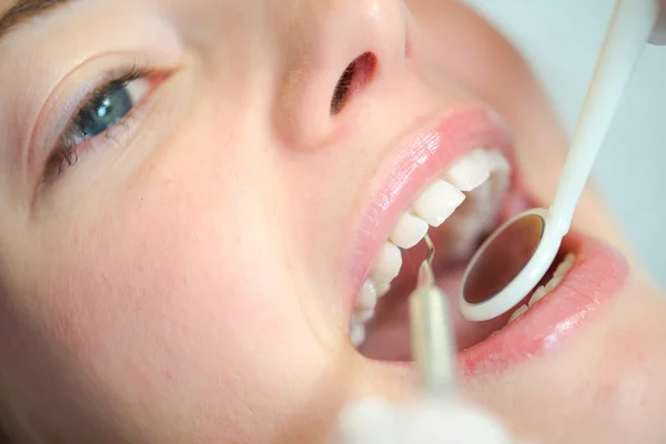 Крупный план женского рта у дантиста — стоковое фото
