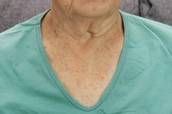 Chest Neck Very Old Woman Close Non Edit Skin Texture — Stock Photo, Image