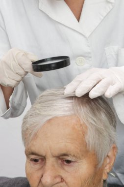 Doktor yaşlı kadının kafa derisini, kafa derisini, egzama, dermatit, sedef, saç kaybı, kepek ya da kuru kafa derisi sorununu inceliyor.