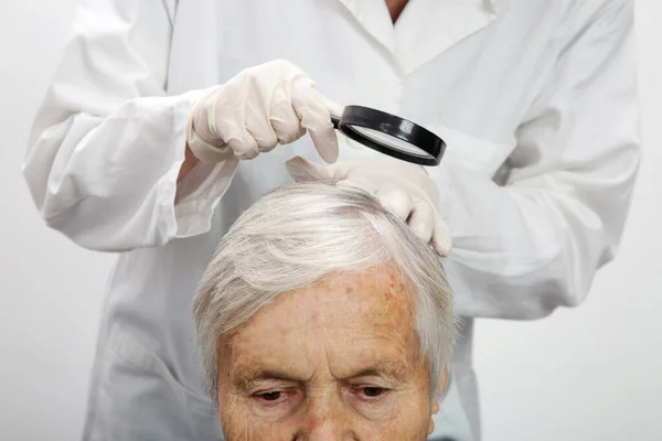 シニア女性の髪の頭皮を調べる医師 頭皮湿疹 皮膚炎 ふけや乾燥頭皮の問題 — ストック写真