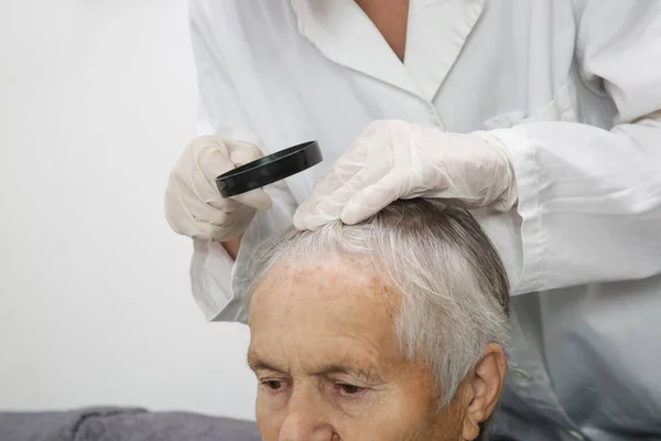 Doktor Yaşlı Kadının Kafa Derisini Kafa Derisini Egzama Dermatit Sedef — Stok fotoğraf