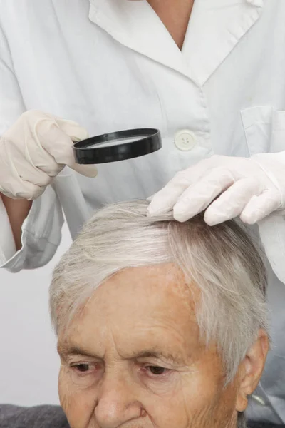 Doctor Examining Senior Woman Hair Scalp Scalp Eczema Dermatitis Psoriasis — Stock Photo, Image