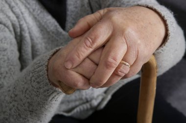 Buruşuk yaşlanmış ellerin yakın görüntüsü 