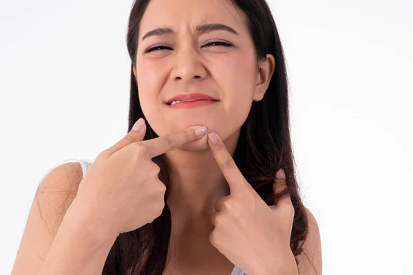 Unhappy Beautiful Asian Woman Squeezes Acne Face Beauty White Background — Stock Photo, Image