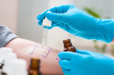 Cilt alerjisi testi