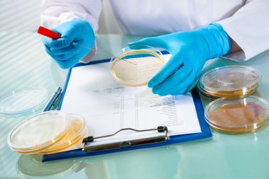 Mikroplar büyüyen ile agar plaka