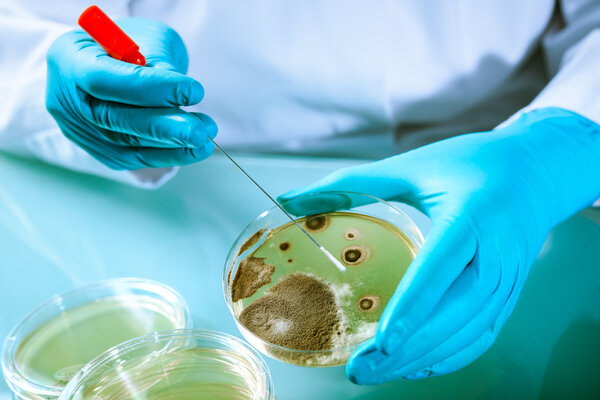 Agar plate with growing germs