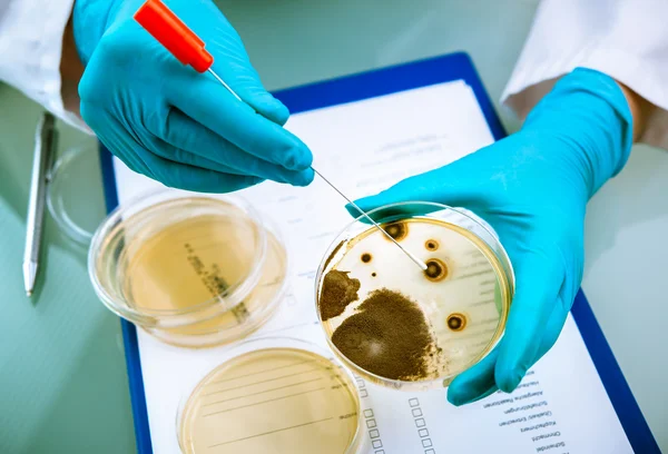 Placa de Agar con gérmenes en crecimiento — Foto de Stock